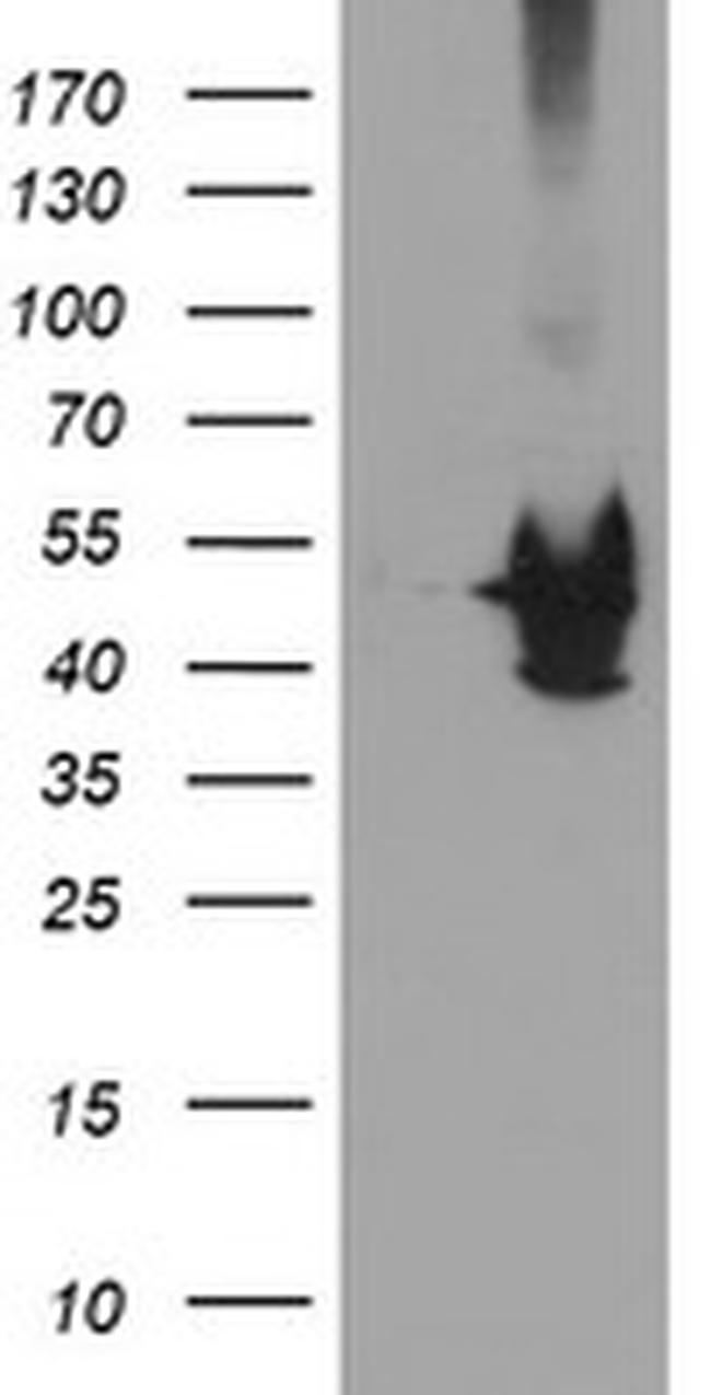 KCNAB1 Antibody in Western Blot (WB)