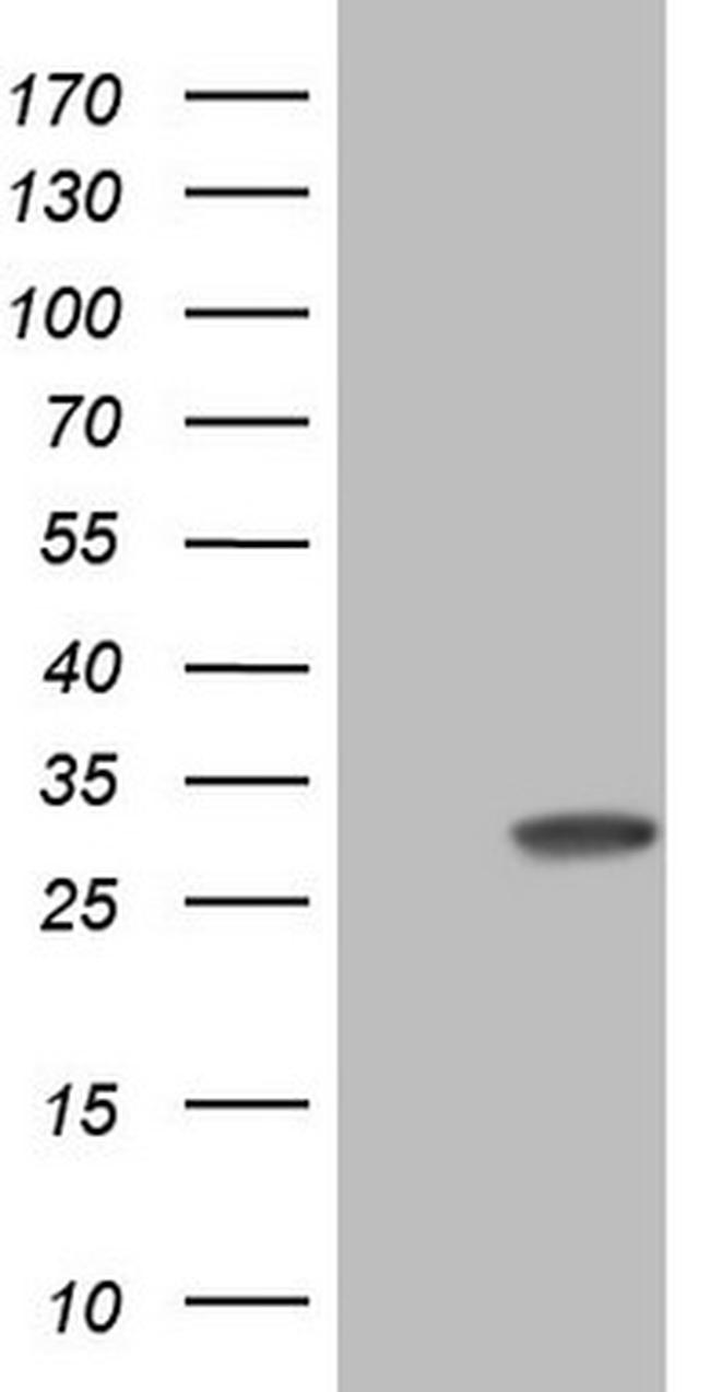 KCNIP2 Antibody in Western Blot (WB)