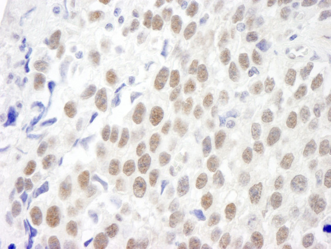 KIAA0082 Antibody in Immunohistochemistry (IHC)