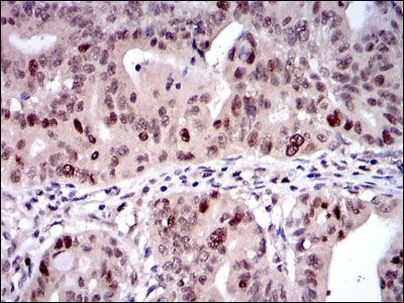 KID Antibody in Immunohistochemistry (Paraffin) (IHC (P))