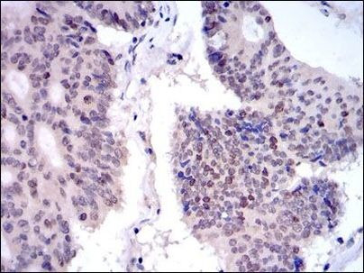 KID Antibody in Immunohistochemistry (Paraffin) (IHC (P))