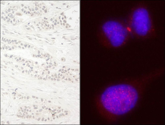 KIF14 Antibody in Immunohistochemistry (IHC)