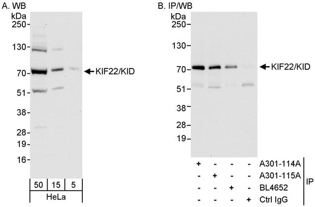 KIF22/KID Antibody in Western Blot (WB)