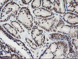 KIF25 Antibody in Immunohistochemistry (Paraffin) (IHC (P))