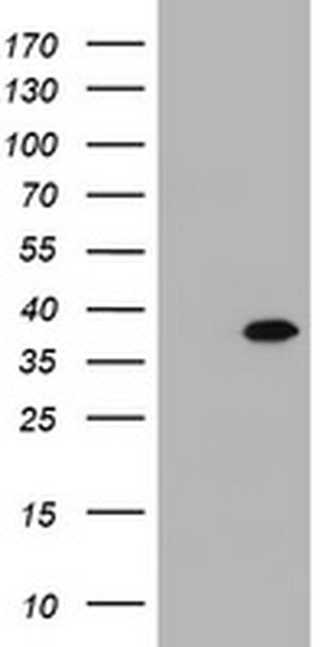 KIF25 Antibody in Western Blot (WB)