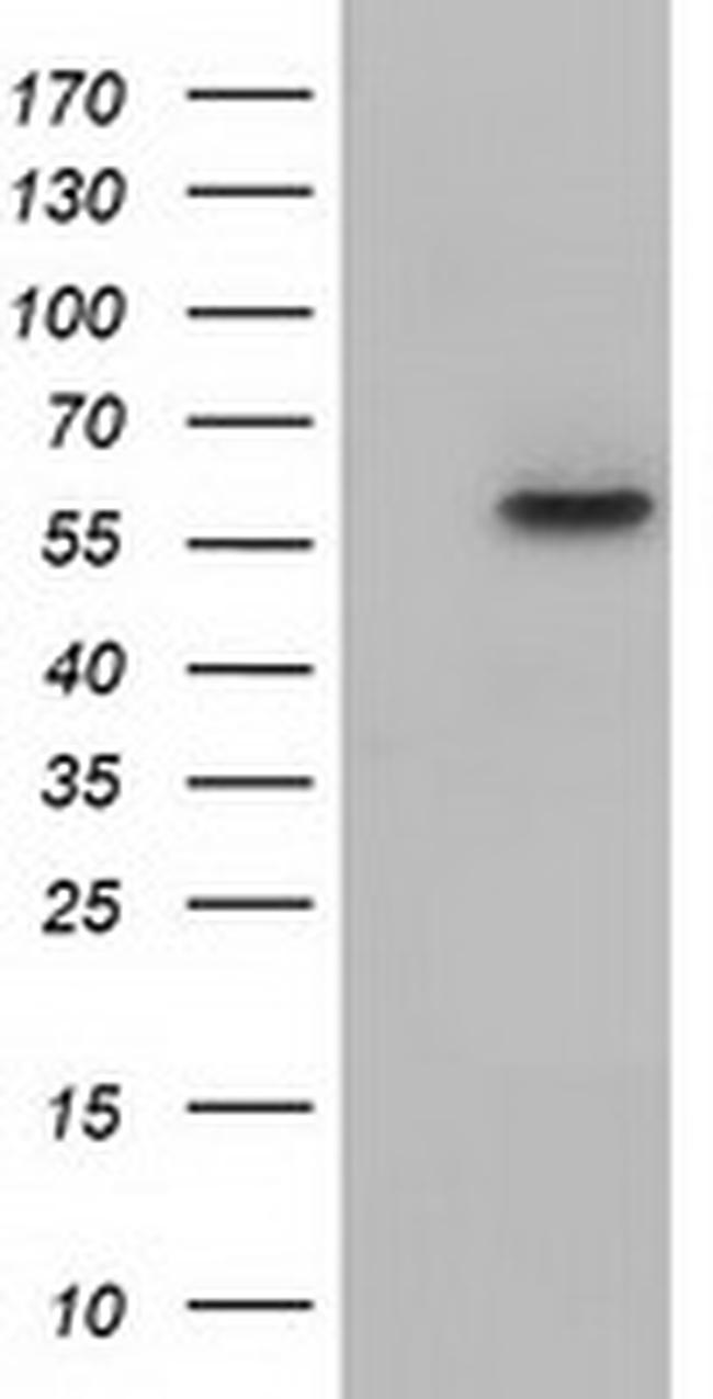 KLHL2 Antibody in Western Blot (WB)