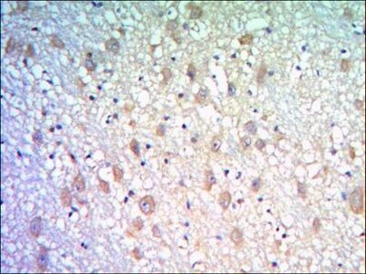 KLHL21 Antibody in Immunohistochemistry (Paraffin) (IHC (P))