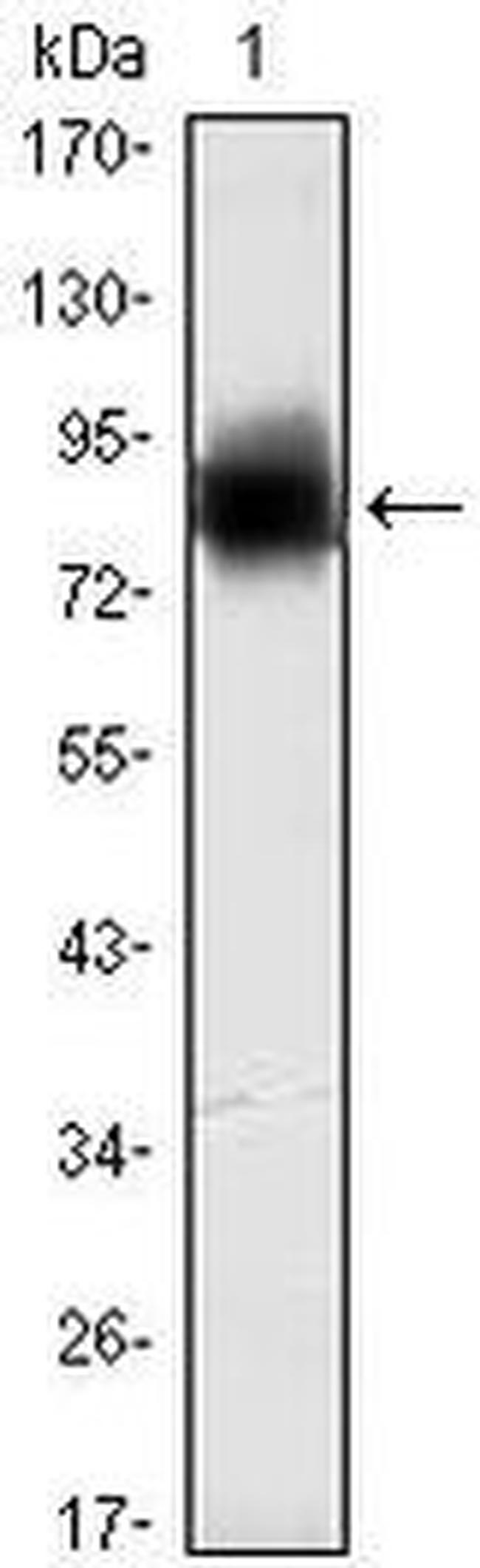 KLHL21 Antibody in Western Blot (WB)