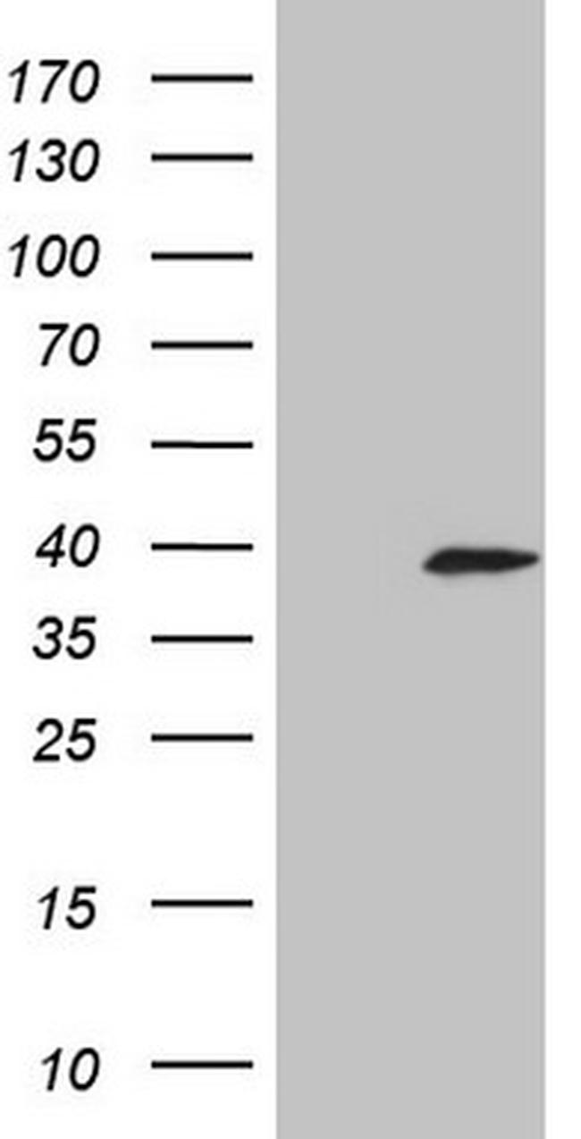 KLK3 Antibody in Western Blot (WB)