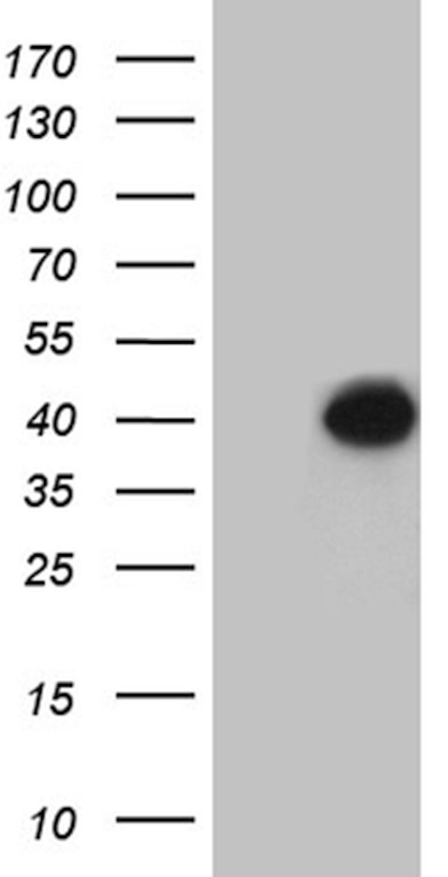 KLRB1 Antibody in Western Blot (WB)