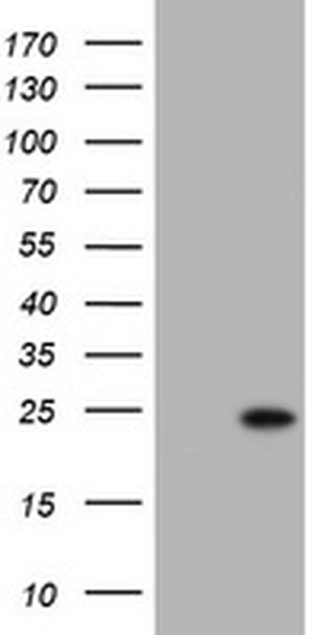 KRAS Antibody in Western Blot (WB)