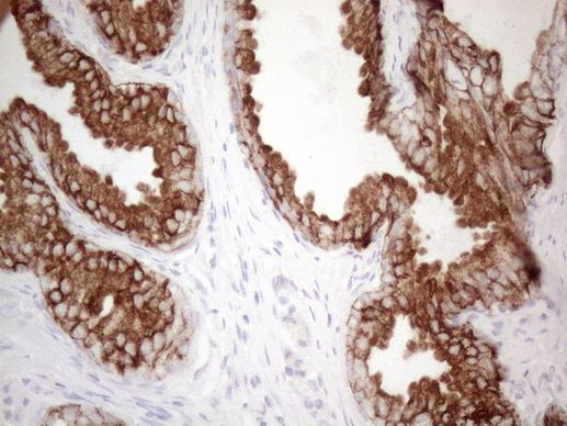 KRT16 Antibody in Immunohistochemistry (Paraffin) (IHC (P))