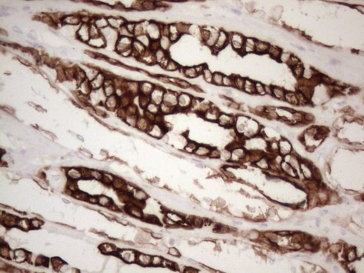 KRT16 Antibody in Immunohistochemistry (Paraffin) (IHC (P))