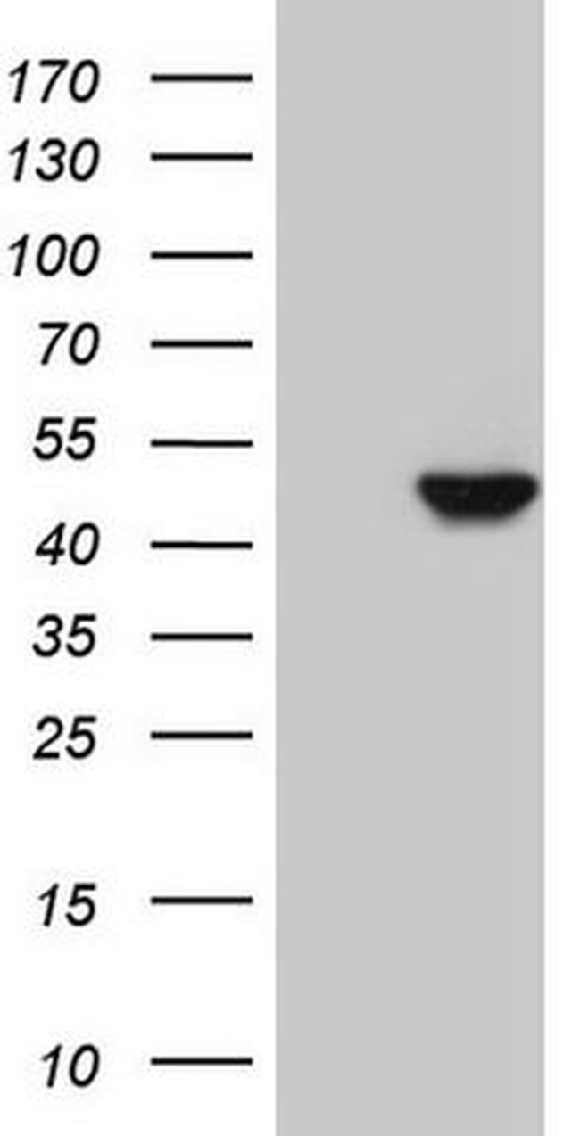 KRT16 Antibody in Western Blot (WB)