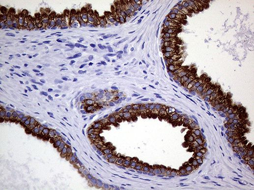 KRT18 Antibody in Immunohistochemistry (Paraffin) (IHC (P))