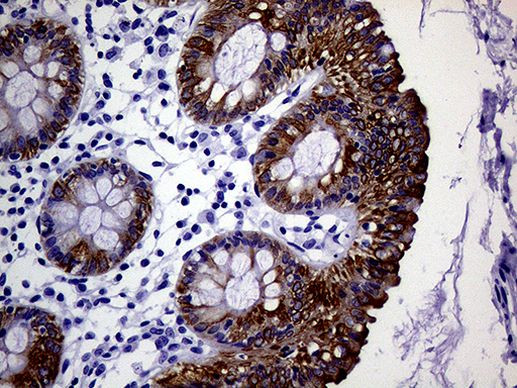 KRT18 Antibody in Immunohistochemistry (Paraffin) (IHC (P))