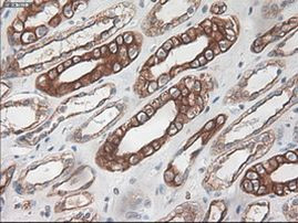 KRT18 Antibody in Immunohistochemistry (Paraffin) (IHC (P))