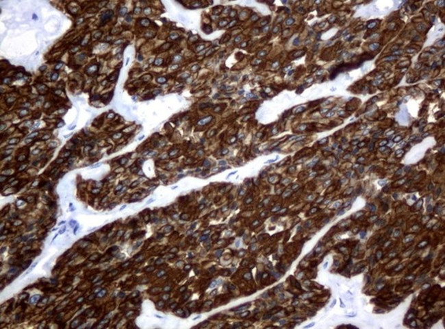 KRT18 Antibody in Immunohistochemistry (Paraffin) (IHC (P))