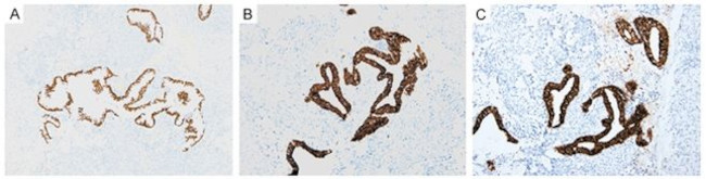 KRT18 Antibody in Immunohistochemistry (Paraffin) (IHC (P))