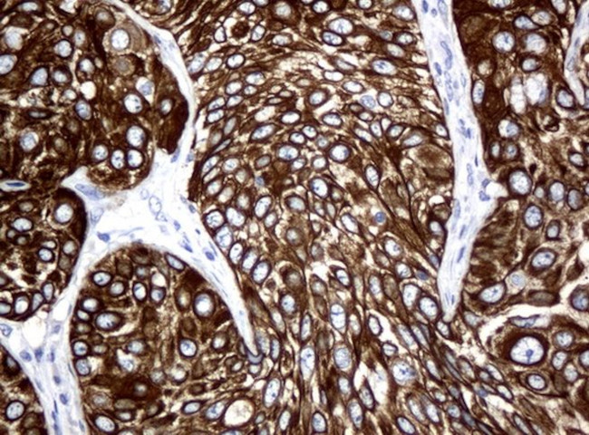 KRT18 Antibody in Immunohistochemistry (Paraffin) (IHC (P))