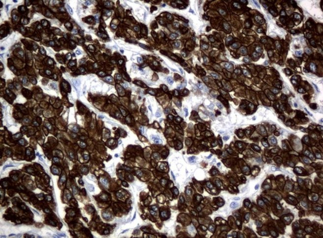 KRT18 Antibody in Immunohistochemistry (Paraffin) (IHC (P))