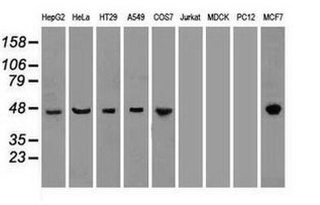 KRT18 Antibody in Western Blot (WB)