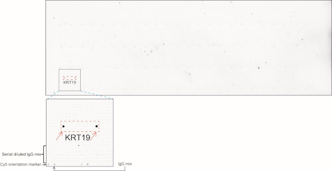 KRT19 Antibody in Peptide array (ARRAY)