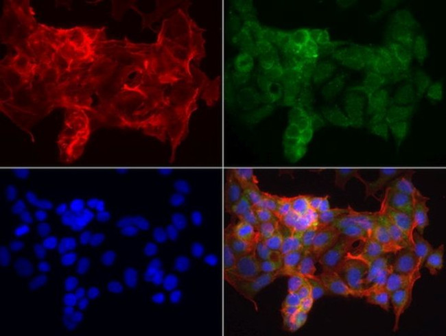 KRT19 Antibody in Immunocytochemistry (ICC/IF)