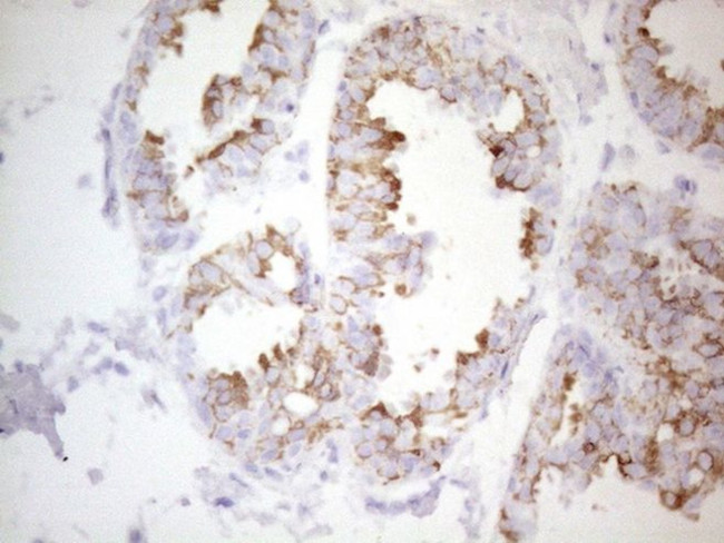 KRT19 Antibody in Immunohistochemistry (Paraffin) (IHC (P))