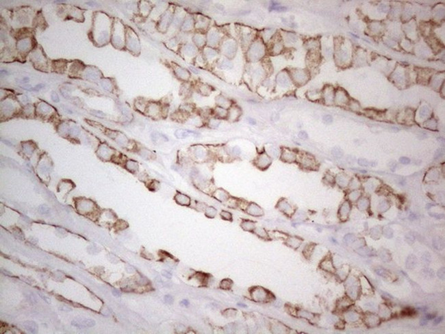 KRT19 Antibody in Immunohistochemistry (Paraffin) (IHC (P))