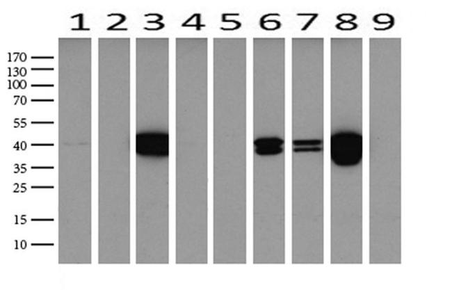 KRT19 Antibody in Western Blot (WB)