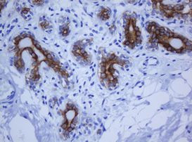 KRT20 Antibody in Immunohistochemistry (Paraffin) (IHC (P))