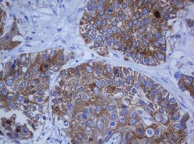 KRT20 Antibody in Immunohistochemistry (Paraffin) (IHC (P))