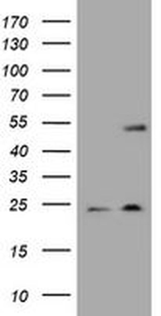 KRT20 Antibody in Western Blot (WB)