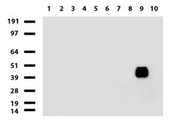 KRT20 Antibody in Western Blot (WB)