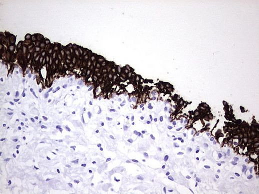 KRT7 Antibody in Immunohistochemistry (Paraffin) (IHC (P))