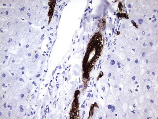 KRT7 Antibody in Immunohistochemistry (Paraffin) (IHC (P))