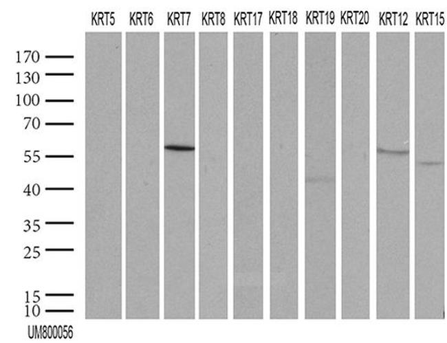 KRT7 Antibody in Western Blot (WB)