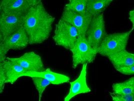 KRT8 Antibody in Immunocytochemistry (ICC/IF)