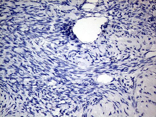 KRT8 Antibody in Immunohistochemistry (Paraffin) (IHC (P))