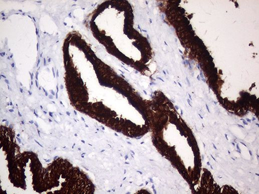 KRT8 Antibody in Immunohistochemistry (Paraffin) (IHC (P))