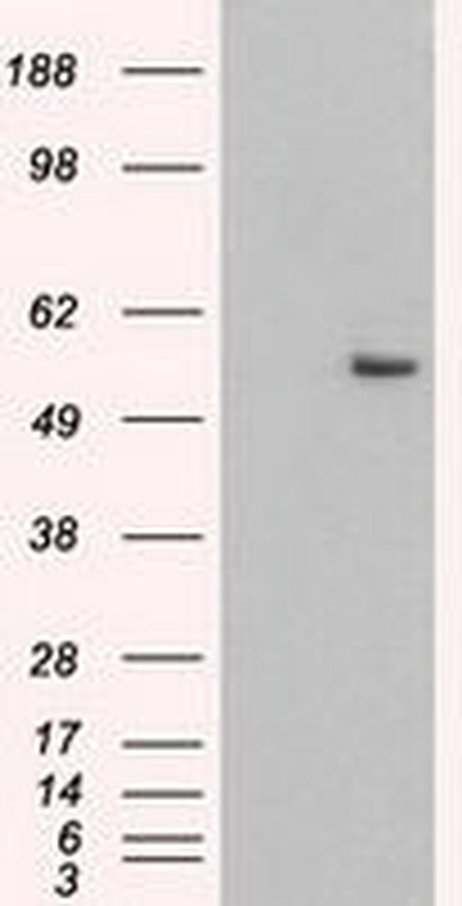 KRT8 Antibody in Western Blot (WB)