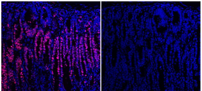 Ki-67 Antibody in Immunohistochemistry (Paraffin) (IHC (P))