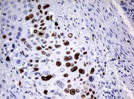 Ki67 Antibody in Immunohistochemistry (Paraffin) (IHC (P))