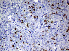 Ki67 Antibody in Immunohistochemistry (Paraffin) (IHC (P))