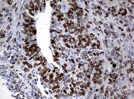 Ki67 Antibody in Immunohistochemistry (Paraffin) (IHC (P))