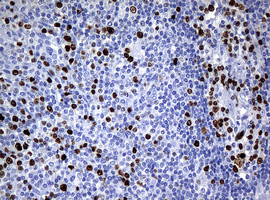 Ki67 Antibody in Immunohistochemistry (Paraffin) (IHC (P))