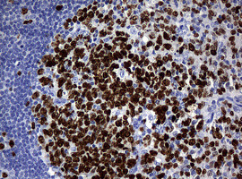 Ki67 Antibody in Immunohistochemistry (Paraffin) (IHC (P))