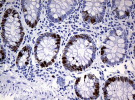 Ki67 Antibody in Immunohistochemistry (Paraffin) (IHC (P))