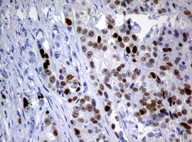 Ki67 Antibody in Immunohistochemistry (Paraffin) (IHC (P))